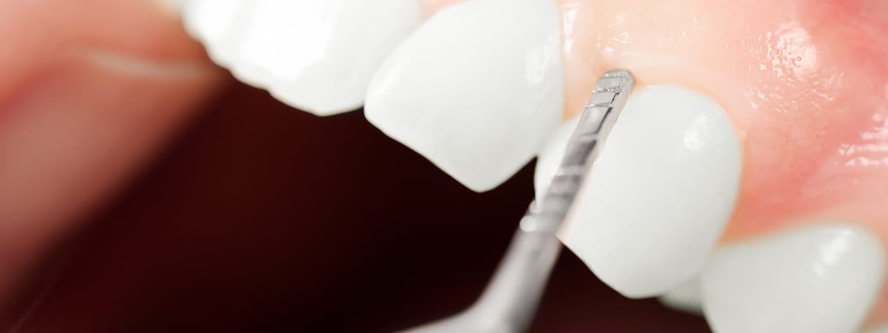 Zahnarzt Nürnberg: Hyaluronsäurebehandlung